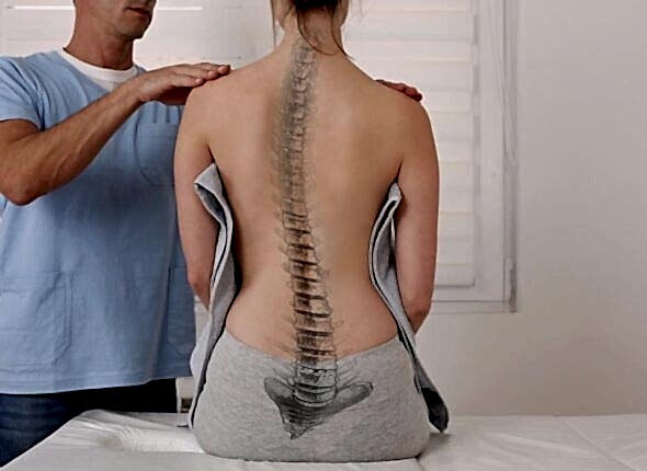 Skolyoz-Schroth-Yontemi